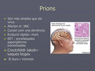 Prions
►   Són més simples que els
    virus.
►   Afecten el SNC
►   Cursen com una demència.
►   Evolució ràpida i mort.
►   EET : encefalopatia
    espongiforme
    transmissible
► Creutzfeldt-Jakob=
    vaques boges.
► El Kuru= tremolor
 