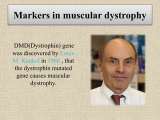 Markers in muscular dystrophy
DMD(Dystrophin) gene
was discovered by Louis
M. Kunkel in 1986 , that
the dystrophin mutated
gene causes muscular
dystrophy.
 