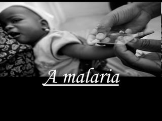 A malaria 