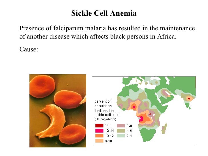 Malaria