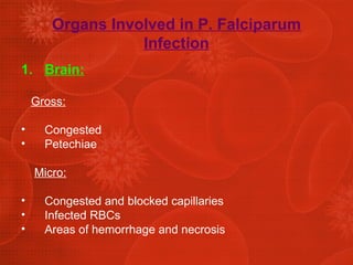 Organs Involved in P. Falciparum Infection Brain: Gross: Congested  Petechiae Micro: Congested and blocked capillaries Infected RBCs Areas of hemorrhage and necrosis 