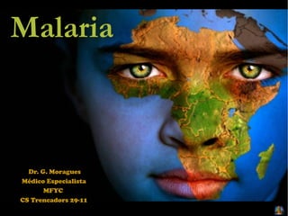 Malaria
Dr. G. Moragues
Médico Especialista
MFYC
CS Trencadors 29-11
 