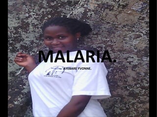 MALARIA.AYEBARE YVONNE.
 