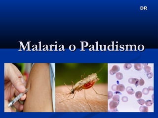 Malaria o PaludismoMalaria o Paludismo
DRDR
 