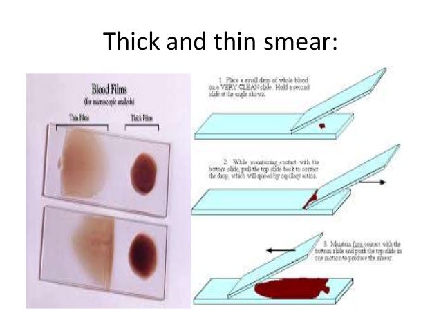 Malaria ppt Malaria ppt
