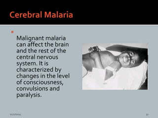 
Malignant malaria
can affect the brain
and the rest of the
central nervous
system. It is
characterized by
changes in the level
of consciousness,
convulsions and
paralysis.
11/17/2014 32