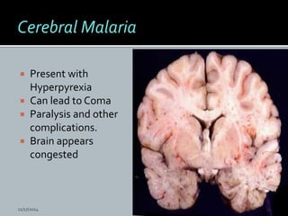  Present with
Hyperpyrexia
Can lead to Coma
Paralysis and other
complications.
Brain appears
congested
11/17/2014 33