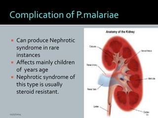  Can produce Nephrotic
syndrome in rare
instances
Affects mainly children
of years age
Nephrotic syndrome of
this type is usually
steroid resistant.
11/17/2014 34