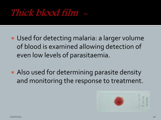  Used for detecting malaria: a larger volume
of blood is examined allowing detection of
even low levels of parasitaemia.
Also used for determining parasite density
and monitoring the response to treatment.
11/17/2014 40