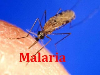 Malaria
 