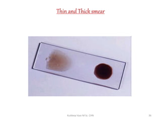 Thin and Thick smear
36Kuldeep Vyas M.Sc. CHN
 