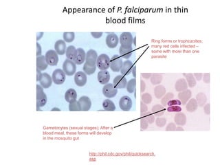 Ring forms or trophozoites;
many red cells infected –
some with more than one
parasite
Gametocytes (sexual stages); After a
blood meal, these forms will develop
in the mosquito gut
Appearance of P. falciparum in thin
blood films
http://phil.cdc.gov/phil/quicksearch.
asp
 