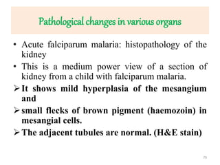 Pathological changes in various organs
• Acute falciparum malaria: histopathology of the
kidney
• This is a medium power view of a section of
kidney from a child with falciparum malaria.
It shows mild hyperplasia of the mesangium
and
small flecks of brown pigment (haemozoin) in
mesangial cells.
The adjacent tubules are normal. (H&E stain)
79
 