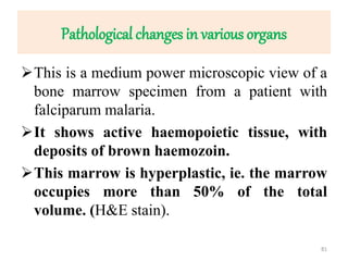 Pathological changes in various organs
This is a medium power microscopic view of a
bone marrow specimen from a patient with
falciparum malaria.
It shows active haemopoietic tissue, with
deposits of brown haemozoin.
This marrow is hyperplastic, ie. the marrow
occupies more than 50% of the total
volume. (H&E stain).
81
 
