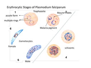 Erythrocytic Stages of Plasmodium falciparum
Trophozoite
Malaria pigment
Maurer's dots
Male
Female
Gametocytes
schizonts
multiple rings
accole form
 