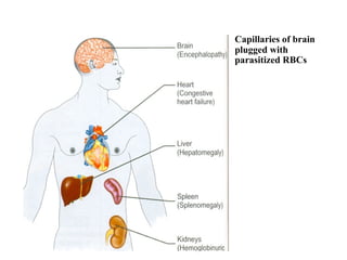Capillaries of brain
plugged with
parasitized RBCs
 