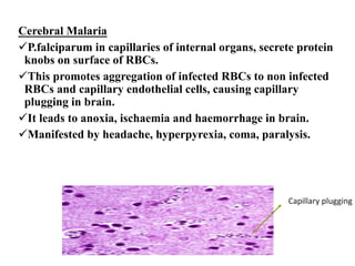 Cerebral Malaria
üP.falciparum in capillaries of internal organs, secrete protein
knobs on surface of RBCs.
üThis promotes aggregation of infected RBCs to non infected
RBCs and capillary endothelial cells, causing capillary
plugging in brain.
üIt leads to anoxia, ischaemia and haemorrhage in brain.
üManifested by headache, hyperpyrexia, coma, paralysis.
Capillary plugging
 