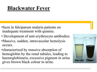 Blackwater Fever
•Seen in falciparum malaria patients on
inadequate treatment with quinine.
• Development of anti-erythrocyte antibodies.
•Massive, sudden, intravascular hemolysis
occurs.
•characterized by massive absorption of
hemoglobin by the renal tubules, leading to
haemoglobinuria, excessive pigment in urine
gives brown black colour to urine.
 