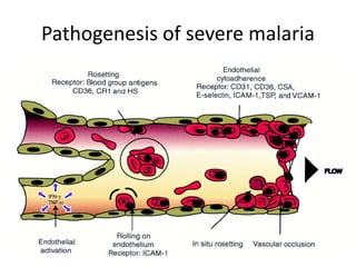 Pathogenesis of severe malaria
 