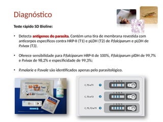 Teste rápido SD Bioline:
• Detecta antígenos do parasita. Contém uma tira de membrana revestida com
anticorpos específicos contra HRP-II (T1) e pLDH (T2) de P.falciparum e pLDH de
P.vivax (T3).
• Oferece sensibilidade para P.falciparum HRP-II de 100%, P.falciparum plDH de 99,7%
e P.vivax de 98,2% e especificidade de 99,3%;
• P.malarie e P.ovale são identificados apenas pelo parasitológico.
Diagnóstico
 