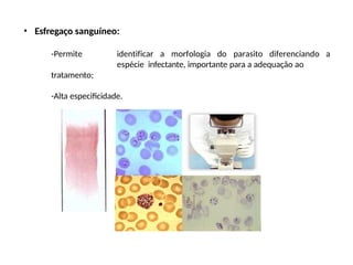 • Esfregaço sanguíneo:
-Permite identificar a morfologia do parasito diferenciando a
espécie infectante, importante para a adequação ao
tratamento;
-Alta especificidade.
 