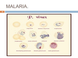 MALARIA.
12
 