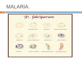 MALARIA.
13
 