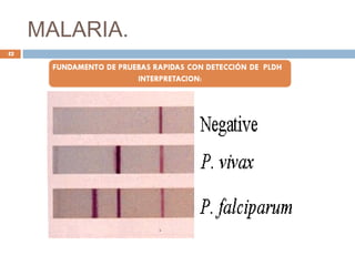 MALARIA.
42
 