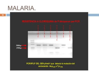 MALARIA.
PCR/RFLP DEL GEN pfmdr1 que detecta la mutaciòn delPCR/RFLP DEL GEN pfmdr1 que detecta la mutaciòn del
aminoàcido Aspaminoàcido Asp12461246 a Tyra Tyr1246.1246.
500bp500bp
250bp250bp
RESISTENCIA A CLOROQUINA de P.falciparum por PCRRESISTENCIA A CLOROQUINA de P.falciparum por PCR
S
E
N
S
I
B
L
E
S
E
N
S
I
B
L
E
S
E
N
S
I
B
L
E
S
E
N
S
I
B
L
E
RR
EE
SS
II
SS
TT
EE
NN
TT
EE
RR
EE
SS
II
SS
TT
EE
NN
TT
EE
61
 