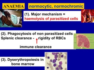 ANAEMIA normocytic, normochromic
(1). Major mechanism =
haemolysis of parasitized cells
(2). Phagocytosis of non parasitized cells
Splenic clearance - rigidity of RBCs
immune clearance
(3). Dyserythropoiesis in
bone marrow
 