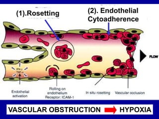 (1).Rosetting (2). Endothelial
Cytoadherence
VASCULAR OBSTRUCTION HYPOXIA
 