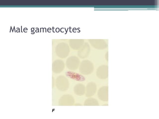 Male gametocytes
 