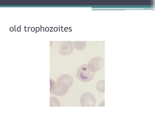 old trophozoites
 