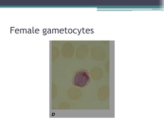 Female gametocytes
 