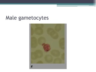 Male gametocytes
 