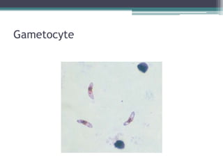 Gametocyte
 