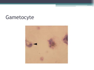 Gametocyte
 
