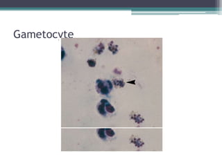 Gametocyte
 