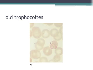 old trophozoites
 