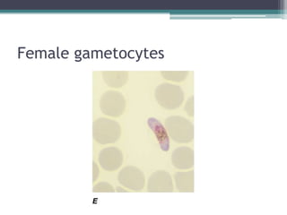 Female gametocytes
 