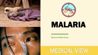 MALARIA
MohmmadRjab Seder
MEDICAL VIEW
 