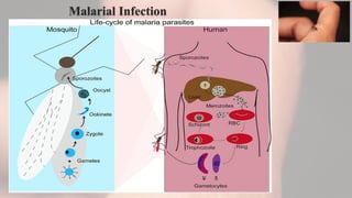Malarial Infection
 
