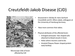 Causative agent of BSE: What is a Prion?