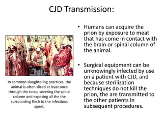 Prion protein is indestructible by heat up to 1000° F(350° C) Hot enough to melt lead.In 1986, 4.5 million cows were incinerated in the U.K. after the discovery of BSE. The ashes, stored in underground concrete containers, were retested again in 1998 and found to still be infected with active prions.