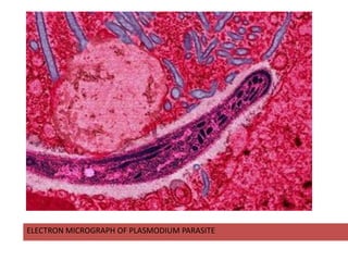 ELECTRON MICROGRAPH OF PLASMODIUM PARASITE