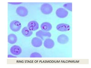 RING STAGE OF PLASMODIUM FALCIPARUM