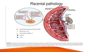 Placental pathology
 