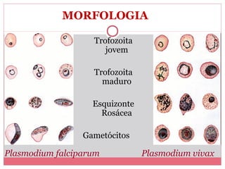 MORFOLOGIA
Trofozoita
jovem
Trofozoita
maduro
Esquizonte
Rosácea
Gametócitos

Plasmodium falciparum

Plasmodium vivax

 