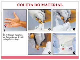 COLETA DO MATERIAL

 