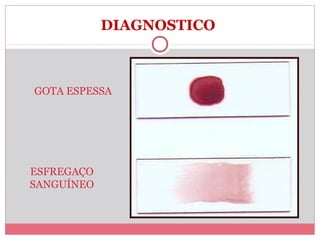 DIAGNOSTICO

GOTA ESPESSA

ESFREGAÇO
SANGUÍNEO

 